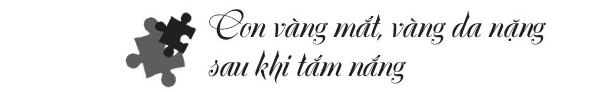 Tưởng tắm nắng chữa vàng da cho con sơ sinh mẹ việt rụng rời khi nghe bác sĩ kết luận - 2