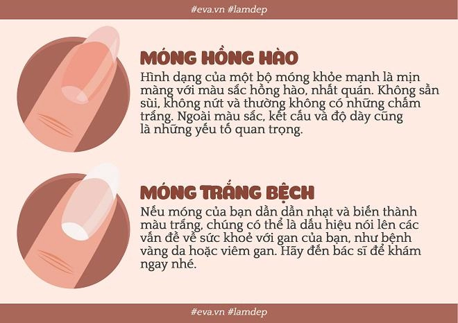 Nếu bộ móng của bạn bỗng trở nên xấu xí thì đều có lý do cả đấy - 1