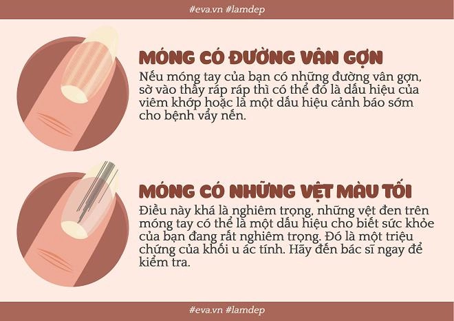 Nếu bộ móng của bạn bỗng trở nên xấu xí thì đều có lý do cả đấy - 3