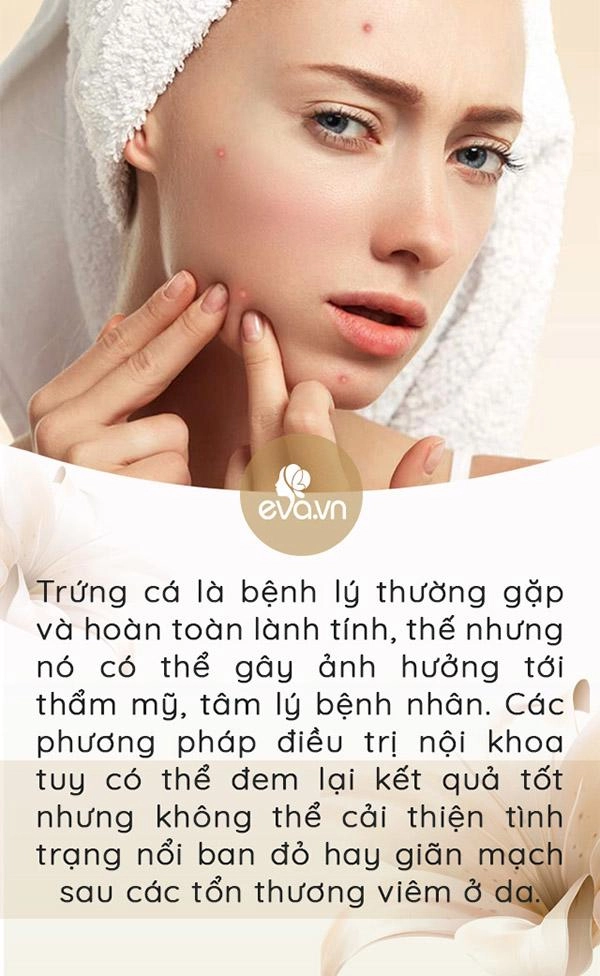 3 ngày nữa noel 7 ngày nữa tết tây làm sao trị mụn trứng cá nhanh mà còn an toàn - 2