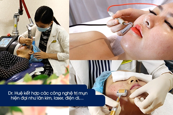 Dr huệ - địa chỉ thẩm mỹ viện và spa trị mụn uy tín tại thành phố hồ chí minh - 3