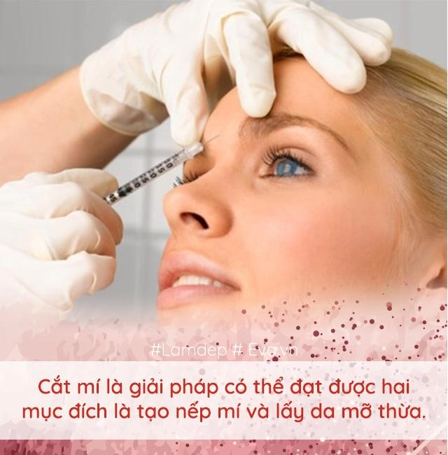 Làm đẹp thế nào khi cứ mãi lẫn lộn nhấn mí với cắt mí đây là điều bạn cần biết - 7