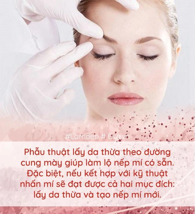 Làm đẹp thế nào khi cứ mãi lẫn lộn nhấn mí với cắt mí đây là điều bạn cần biết - 9