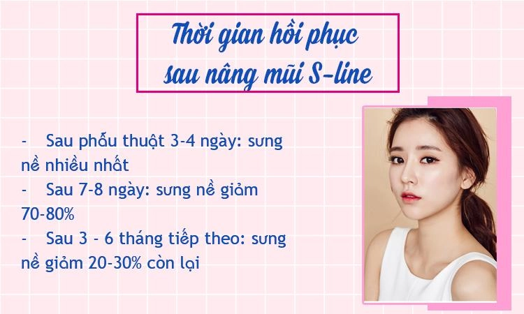 Nâng mũi s-line và những điều bạn cần biết trước khi quyết định bước làm đẹp này - 5