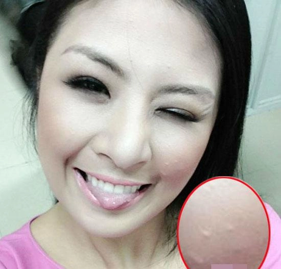 Tiểu vy mai phương thuý và loạt mỹ nhân dù make-up kỹ càng vẫn lộ làn da chi chít mụn - 3