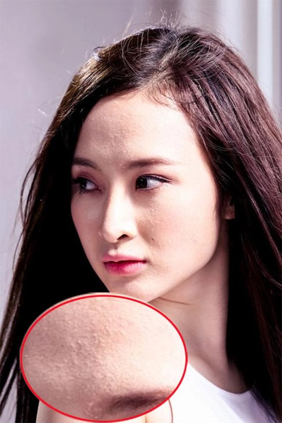 Tiểu vy mai phương thuý và loạt mỹ nhân dù make-up kỹ càng vẫn lộ làn da chi chít mụn - 4