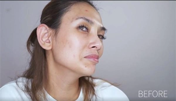 Tiểu vy mai phương thuý và loạt mỹ nhân dù make-up kỹ càng vẫn lộ làn da chi chít mụn - 5