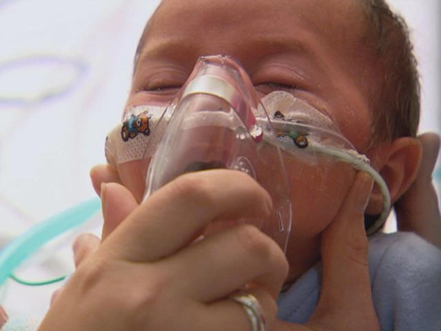 Nguyên nhân gây viêm phổi kéo dài ở trẻ dưới 5 tuổi - 2