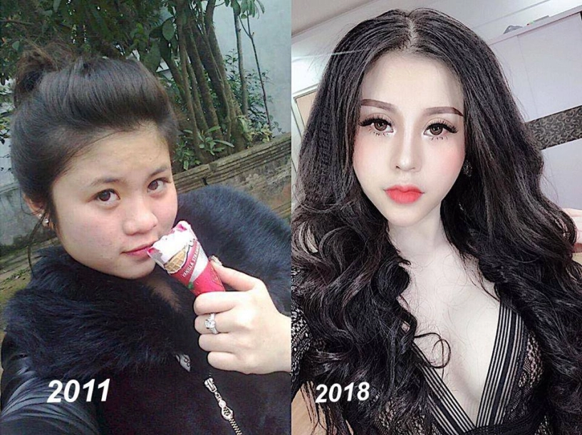 3 gái xấu phẫu thuật để hóa hotgirl diện mạo con đẻ khiến ai cũng trầm trồ - 4