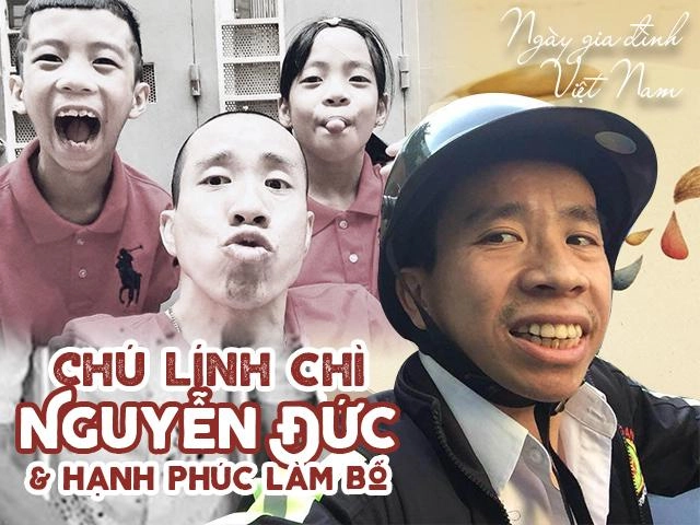 30 năm sau cuộc phẫu thuật tách rời lịch sử chú lính chì hạnh phúc làm bố cặp song sinh - 1