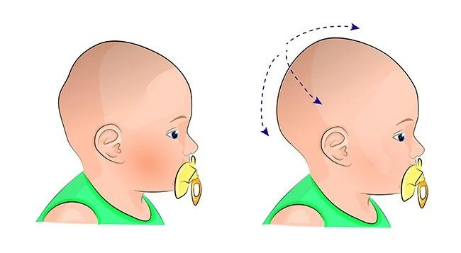 7 dấu hiệu tưởng bình thường nhưng cực nguy hiểm ở trẻ sơ sinh cha mẹ chớ coi thường - 4