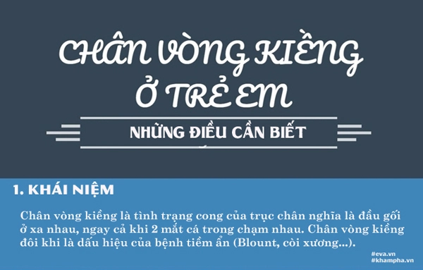 Bác sĩ chỉ cách phát hiện trẻ bị chân vòng kiềng ngay từ nhỏ - 1