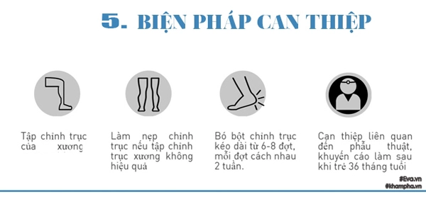 Bác sĩ chỉ cách phát hiện trẻ bị chân vòng kiềng ngay từ nhỏ - 5