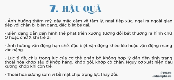 Bác sĩ chỉ cách phát hiện trẻ bị chân vòng kiềng ngay từ nhỏ - 7