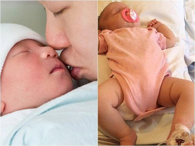 Bị người lạ hôn bé 4 tuần tuổi mắt sưng phồng chảy nước giành giật sự sống - 8