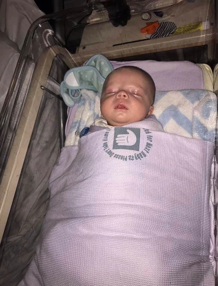 Bị người lạ hôn bé 4 tuần tuổi mắt sưng phồng chảy nước giành giật sự sống - 1