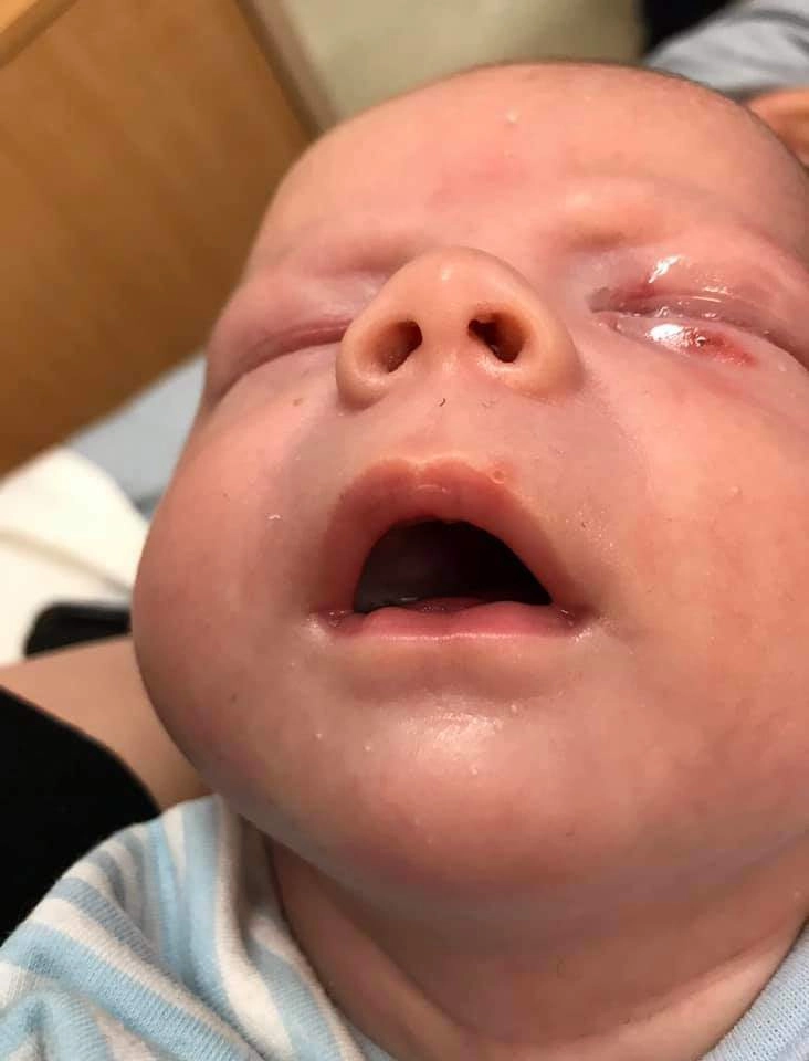 Bị người lạ hôn bé 4 tuần tuổi mắt sưng phồng chảy nước giành giật sự sống - 4