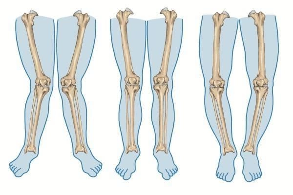 Dấu hiệu bất thường ở chân trẻ mẹ nên cho bé tới bệnh viện sớm - 1