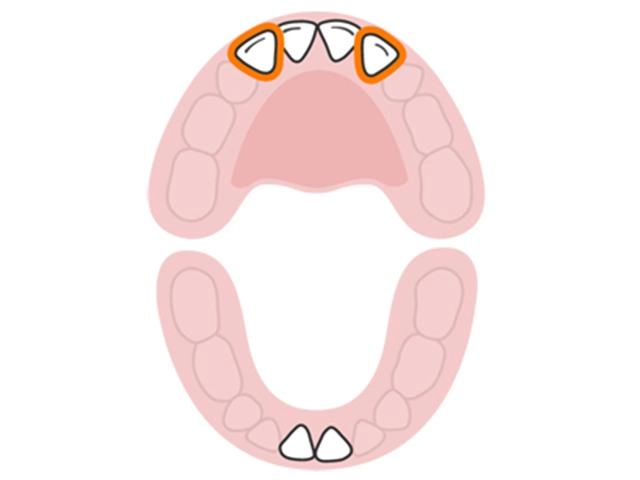 Lịch mọc răng ở trẻ - không theo trình tự như nhiều mẹ vẫn tưởng - 4