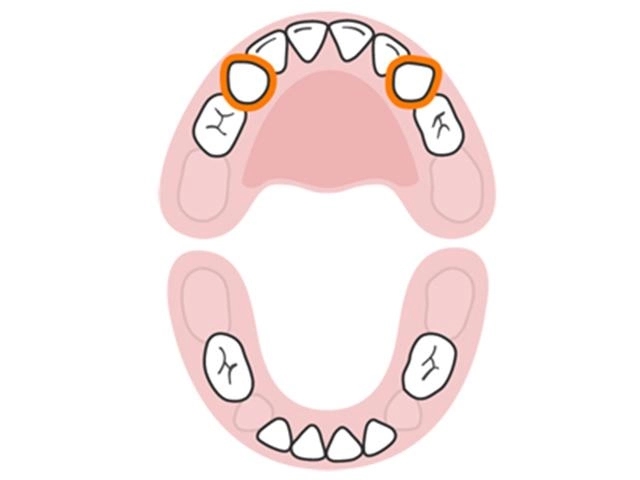 Lịch mọc răng ở trẻ - không theo trình tự như nhiều mẹ vẫn tưởng - 8