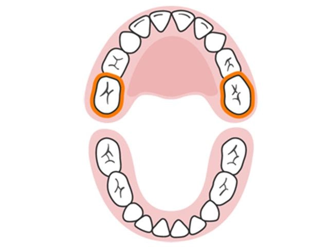 Lịch mọc răng ở trẻ - không theo trình tự như nhiều mẹ vẫn tưởng - 11