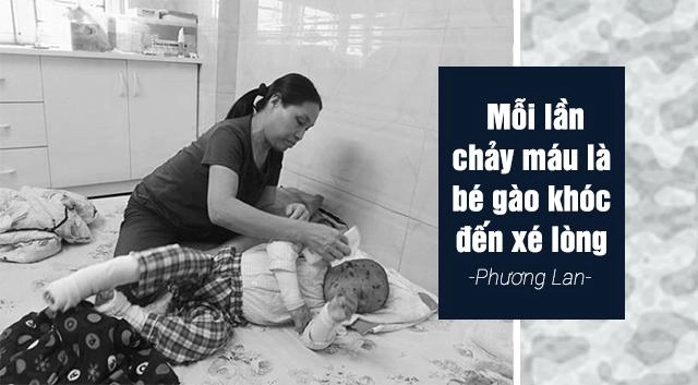 Mẹ đơn thân bán 2 căn nhà cưu mang bé bị bệnh nặng mỗi tháng tiêu tốn 100 triệu đồng - 4