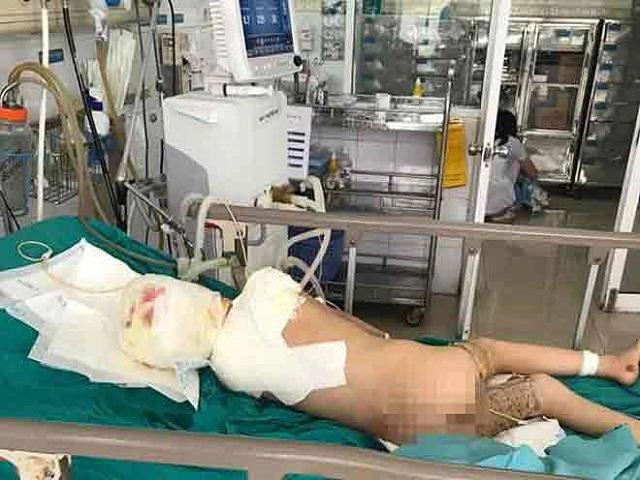 Nhờ bà trông cháu một lúc bố mẹ trẻ hốt hoảng khi nhìn cảnh tượng kinh hoàng - 3