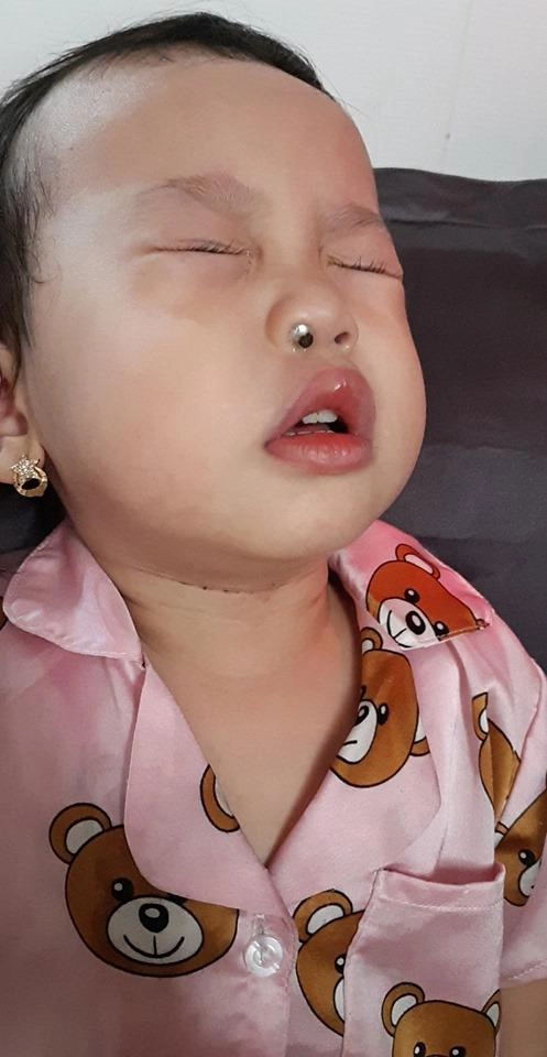 Con trai gặp nạn vì thứ siêu nhỏ tuấn hưng cảnh báo cha mẹ nào cũng hốt hoảng - 4