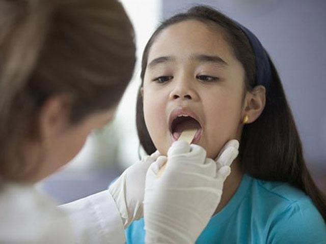 Trẻ bị viêm amidan sốt mấy ngày và khi nào cần đưa đi viện - 5