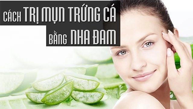 15 cách trị mụn trứng cá tại nhà bằng thiên nhiên an toàn hiệu quả nhất - 4