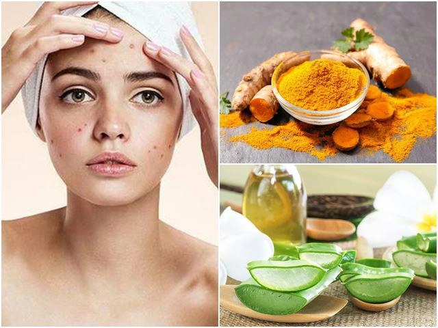 Cách trị mụn bọc sưng đỏ mủ ở mũi cằm tại nhà an toàn hiệu quả - 18