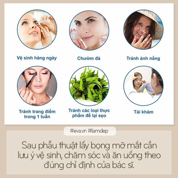 Bỏ túi ngay những kiến thức này nếu không muốn trở thành thảm họa sau cắt bọng mỡ mắt - 5