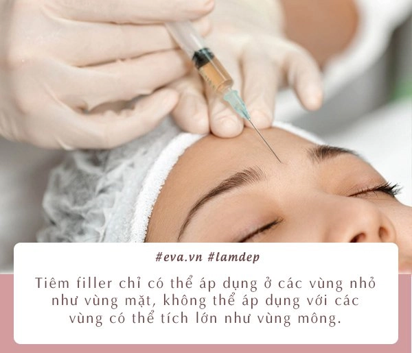 Chuyện cô gái bị hoại tử nặng nề vùng mông do tiêm filler và lời cảnh tỉnh của bác sĩ - 7