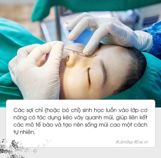 Không mới nhưng không phải nàng nào cũng biết tới phương pháp nâng mũi nhanh gọn này - 2