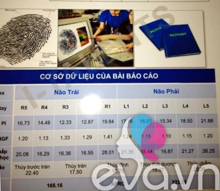 Sinh trắc vân tay tốn 3 triệu vẫn hút khách - 1