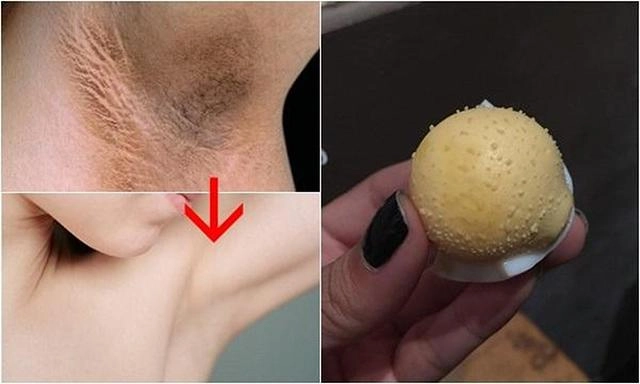 20 cách trị hôi nách tận gốc đơn giản tại nhà từ những nguyên liệu tự nhiên - 6