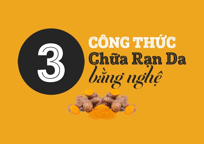 3 công thức chữa rạn da bằng nghệ tươi vô cùng ngon-bổ-rẻ - 1