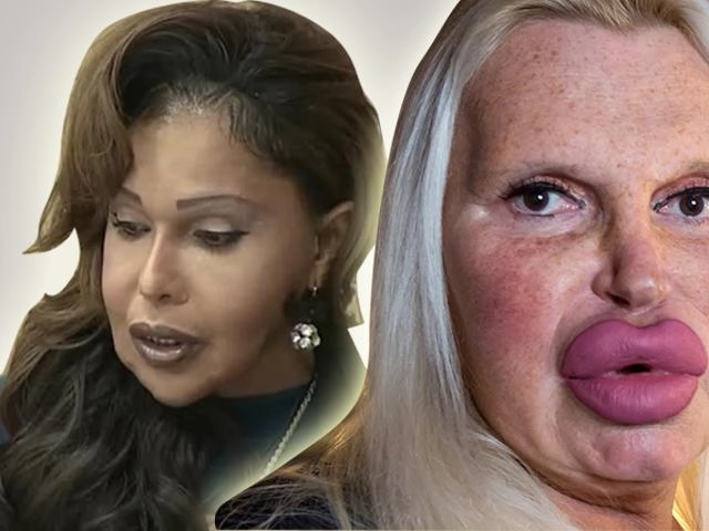 3 năm sau scandal giật chồng my sói người đẹp này tiếp tục gây shock bởi khuôn mặt khác lạ - 10