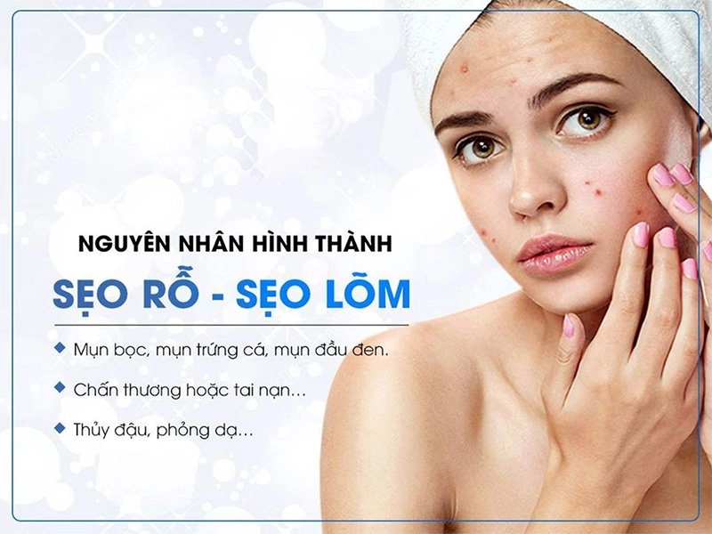 Cách trị sẹo rỗ lâu năm an toàn hiệu quả nhất từ nguyên liệu dễ kiếm - 2