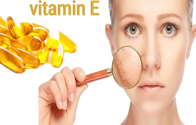 Cách trị sẹo rỗ lâu năm an toàn hiệu quả nhất từ nguyên liệu dễ kiếm - 3