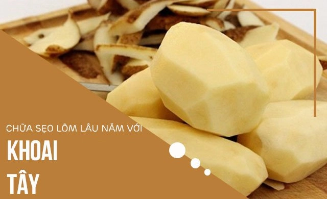 Cách trị sẹo rỗ lâu năm an toàn hiệu quả nhất từ nguyên liệu dễ kiếm - 7