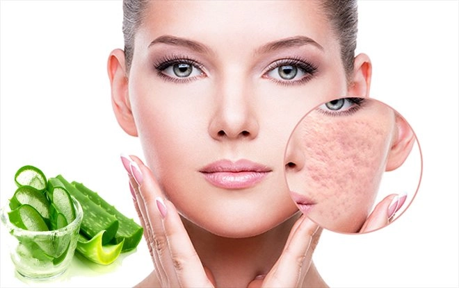 Cách trị sẹo rỗ lâu năm an toàn hiệu quả nhất từ nguyên liệu dễ kiếm - 8