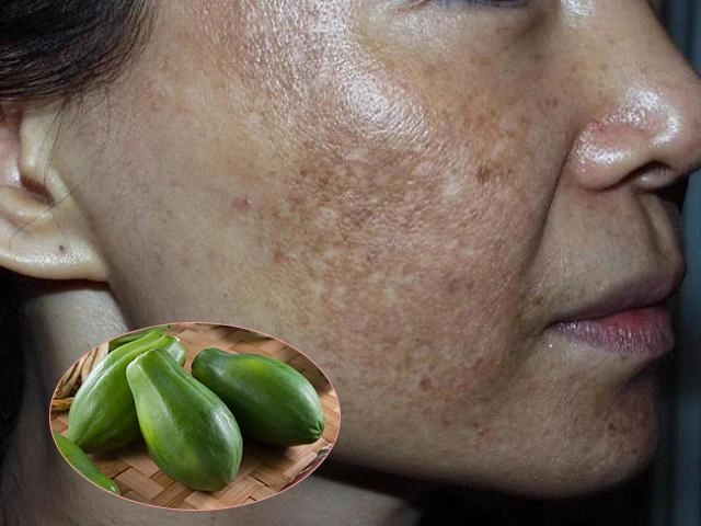 Chán nâng ngực giờ chị em còn treo ngực và đây là kết quả của màn treo ngực định mệnh - 8