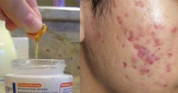 Chỉ cần dùng vitamin e theo cách này bạn sẽ tiết kiệm được cả núi tiền từ mua mỹ phẩm - 2