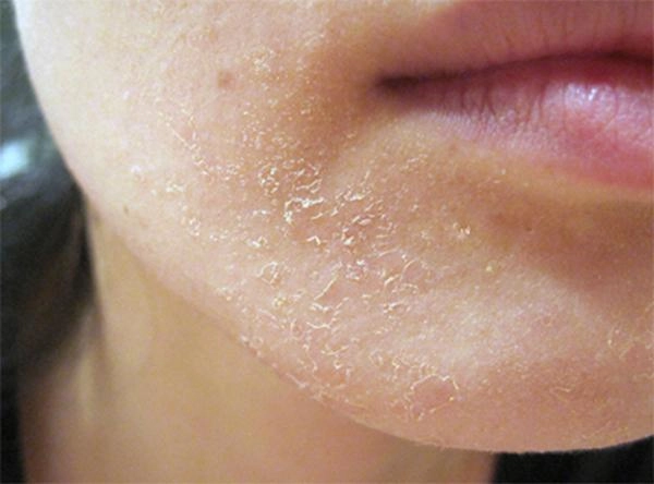 Chỉ cần dùng vitamin e theo cách này bạn sẽ tiết kiệm được cả núi tiền từ mua mỹ phẩm - 5