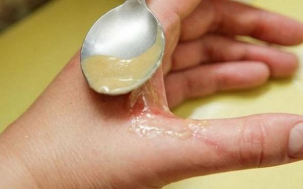 Chỉ cần dùng vitamin e theo cách này bạn sẽ tiết kiệm được cả núi tiền từ mua mỹ phẩm - 6