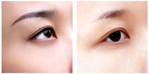 Cứ trộn hành tây với mật ong lông mày lơ thơ đến mấy cũng rậm ngay sau 2 tuần - 1