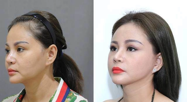 Cứ xui là đập mặt xây lại nhưng lê giang sửa mãi vẫn không khắc phục được điều này - 3