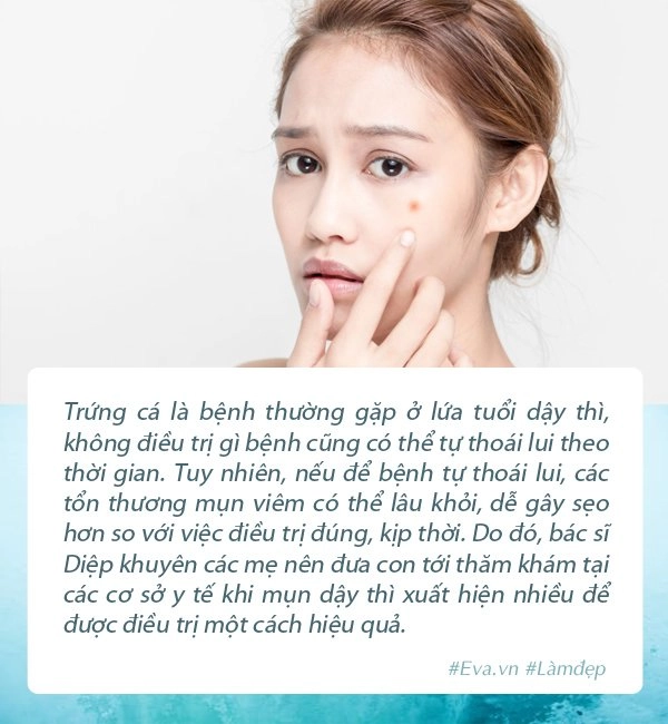 Cùng con đối phó với mụn dậy thì mẹ đừng bỏ qua loạt lời khuyên của chuyên gia - 6