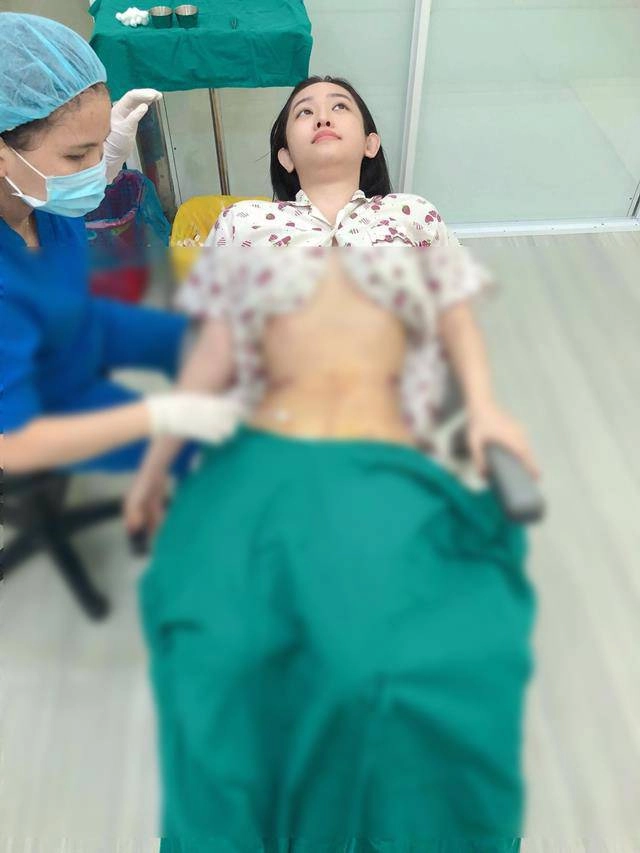 Đã hút 2kg mỡ thừa thúy vi vẫn bị cđm phát hiện dùng app chỉnh eo lệch cả rốn - 8